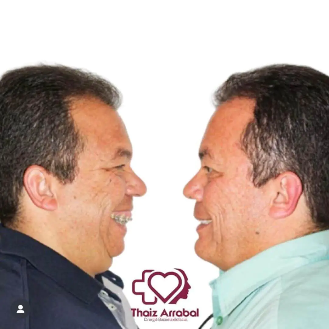 Antes e depois — registro clínico 2 do Instituto da Face
